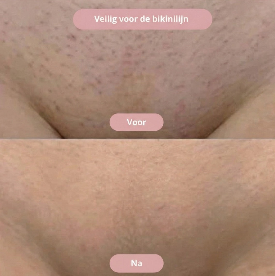 Velora Glide- Intiem scheren zonder irritatie