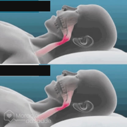 SilentSleep -Vermindert snurken.